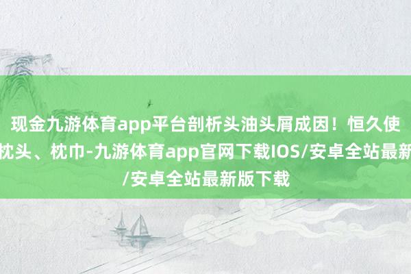 现金九游体育app平台剖析头油头屑成因！恒久使用劣质枕头、枕巾-九游体育app官网下载IOS/安卓全站最新版下载
